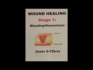 Wound Healing Minute #15: Stages of Healing