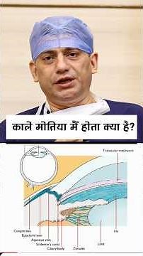 What Actually Happens in Glaucoma? Dr pawan Gupta
