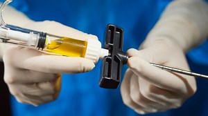 InternalBrace™ Technique for a Lisfranc Injury With IOBP® Procedure for a Lateral Cuneiform Fracture