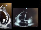 Hocus Pocus: Using POCUS for Volume & Hemodynamics Assessment and Quick Peculiar Diagnoses • Video • MEDtube.net