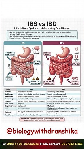 They Sound Similar, But They're NOT the Same! #irritablebowelsyndrome #inflammatoryboweldisease