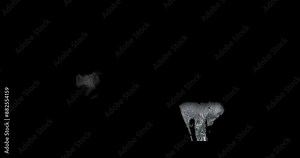 Footage of an MRI hand scan displays comprehensive views for diagnosing hand tumor diseases.