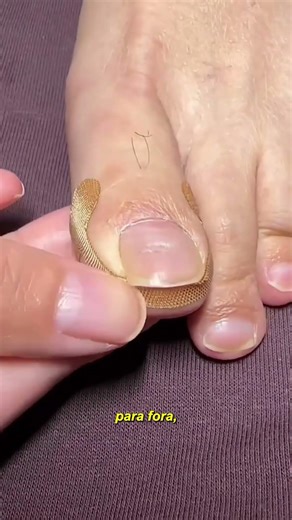 A brilliant invention for ingrown toenails.