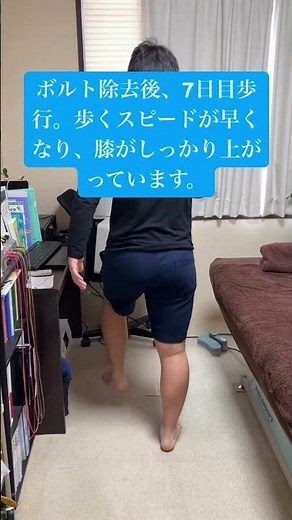 ACL（前十字靭帯損傷）術後の膝痛・可動域制限が鍼灸でここまで改善