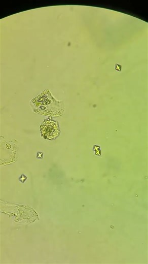 Cristais de Oxalato de Cálcio | Calcium Oxalate Crystals #shorts #urinalysis #microscope #biomed