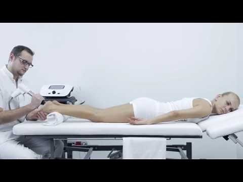 Impactis M - ASTAR - Heel Spur - shockwave therapy