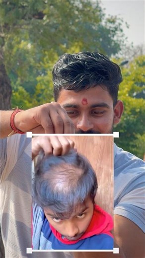 hair problam solf #shrots #motivation #diteplan #hairfall