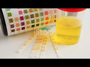 Why Your Pee is Yellow: The Science Explained!