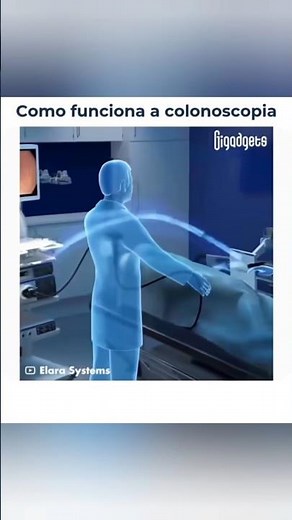 How does a colonoscopy work?