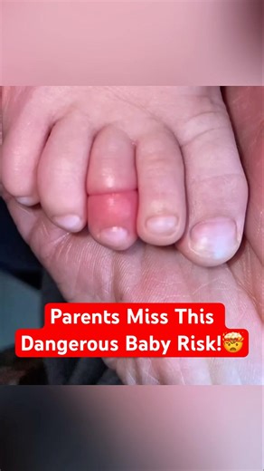 This Tiny Hair Can Seriously Hurt a Baby