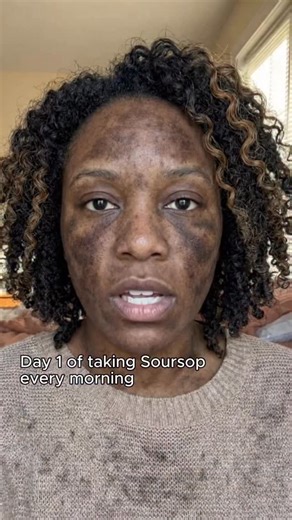 Vanessa Clark on Instagram: "Comment “Tea” for the full recipe 😇 Get your Soursop bitters below 👇 https://amzn.to/3JqcOiT #soursop #womenshealth #usahealth #us #guthealth"