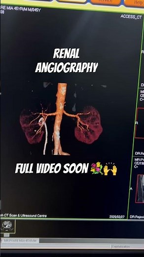 Renal Angiography Procedure Explained Fast #shorts