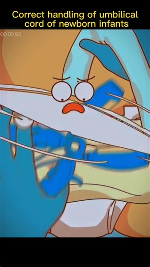 108K views · 368 reactions | #newborn #infants #umbilical #cord #correct #handling #foryou #fyp #sciencefacts #mathematics#physics#life #subject #science #quantumphysics, #fyp #foryou #tiktok #lnteresting#science#physics | Sience | Facebook