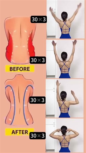 cervical muscle exercises for everyone tennis elbow yoga and chest Exercise at home #cervicalpain