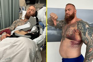 Thor shares graphic surgery photos on Instagram after tearing pectoral muscle in training