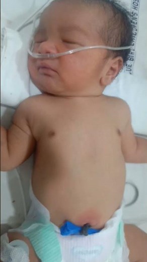 #newbornbaby normal breathing