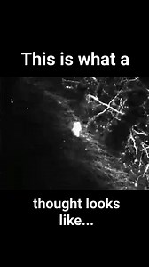36K views · 764 reactions | Yupp, this is what your thoughts look like - neurons forming new connections with neurons in your brain. | Earthly Mission | Facebook