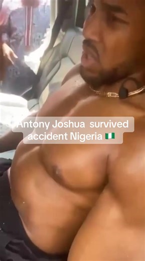 Anthony Joshua Injured in Car Accident in Nigeria