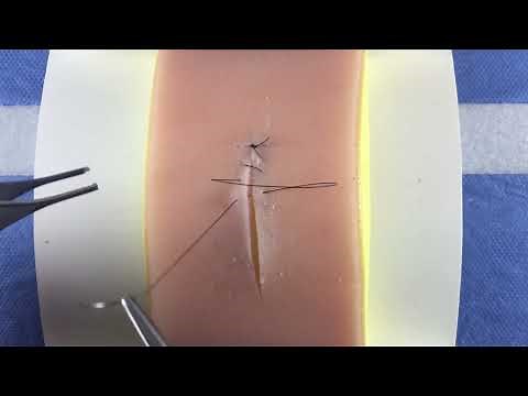 Simple Continuous Running Baseball Suture