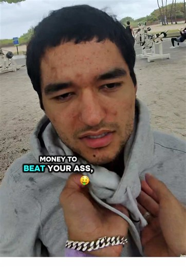 Effective Solutions for Receding Hairline