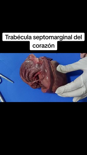 Estructura y Función de la Trabécula Septomarginal en el Corazón