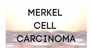 MERKEL CELL CARCINOMA