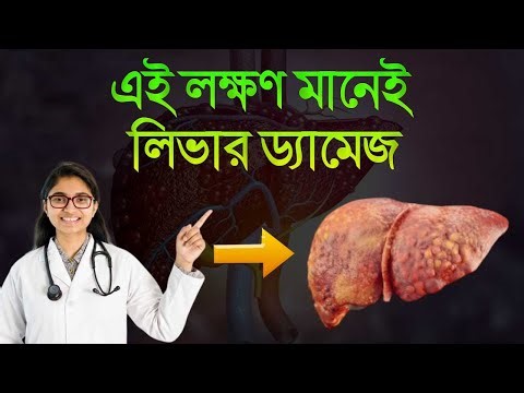 যে লক্ষণগুলো দেখে বোঝা যায় আপনার লিভার ধীরে ধীরে নষ্ট হচ্ছে #লিভারসমস্যা
