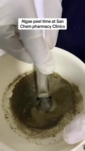 Algae Peel Treatment at San Chem Pharmacy Clinics