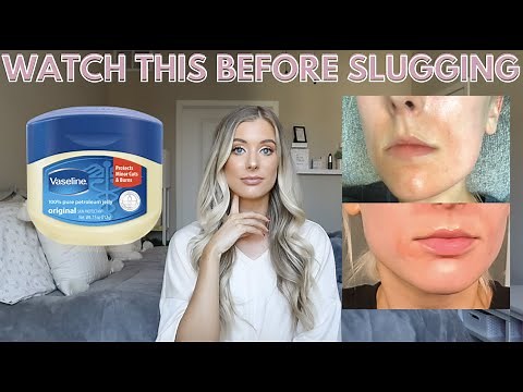 What Is Skincare Slugging? How to Slug Skin | How to Repair Skin Barrier Damage, Vaseline on Face