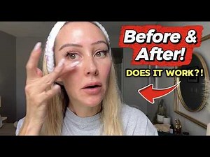 I Tried an Instant Eye Tightener… Wrinkles Gone in Minutes!