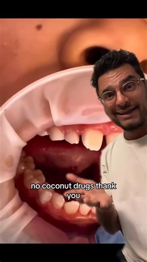 Dentite on Instagram: "👅 Tongue-Tied? Here’s What You Need to Know! 👶🗣️ “Tongue-tied,” or ankyloglossia, happens when the little band of tissue under the tongue (called the frenulum) is shorter or tighter than usual. This can limit tongue movement and cause issues at any age! Why it matters: • 🍼 Infants: Can have trouble latching while breastfeeding, leading to poor feeding or fussiness. • 🗣️ Speech: Kids and even adults may struggle with certain sounds, like “t,” “d,” or “r.” • 😬 Oral hea