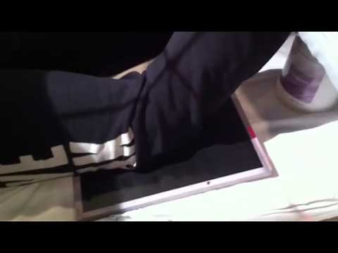 Xray - Knee Camp-Coventry Method