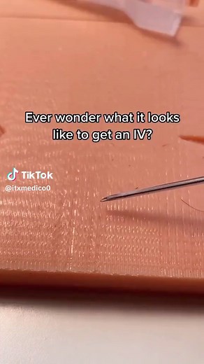 How to Insert IV Lines: Injection Methodology Explained