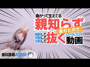 【ASMR 歯医者】腫れて痛い！横向きの親知らず抜歯手術ロールプレイ＊抜歯体験【麻酔〜歯茎切開〜抜歯〜縫合まで】dental dentist roleplay Role-playing