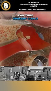 Myringotomy & Grommet Surgery – Relief from recurrent ear infections...