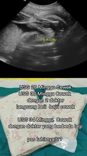 USG dan Dokter: Apa Beda dan Apakah Boleh?