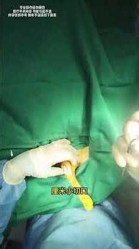 Bilateral Patella Luxation Surgery Explained for Dogs