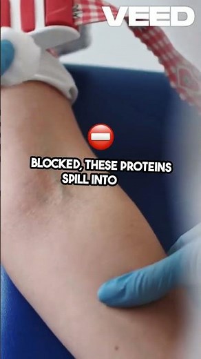Troponin I vs T Heart Damage Explained!