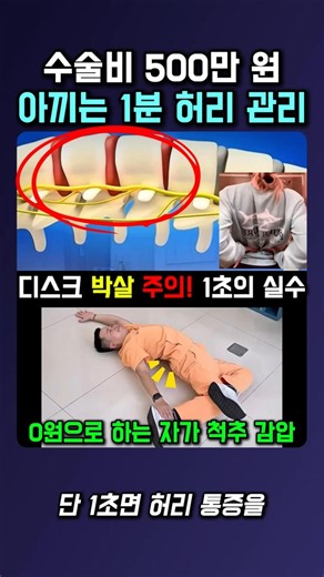 수술비 500만 원 아끼는 1분 허리 관리