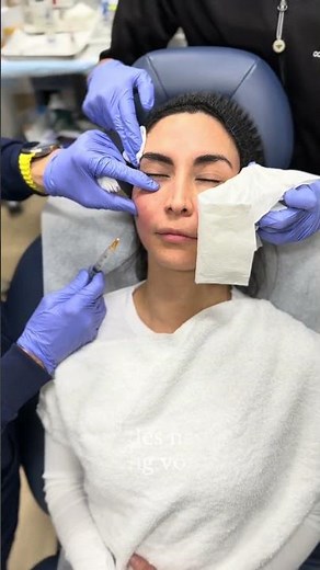 Sculptra with Dr. Mani