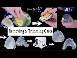 Cast separation (Remove ) from Alginate impression ,Trimming Diagnostic Casts how to remove the cast