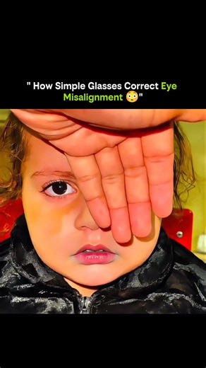 SCIENCE IN DECODED FORM on Instagram: "What looks like an ordinary pair of glasses can quietly solve a complex neurological and muscular problem. Eye misalignment isn’t always about weak eyes — it’s often about how the brain coordinates them. And that’s where optical engineering steps in. 🔹 What eye misalignment really is • One eye points slightly inward, outward, up, or down • The brain struggles to merge two images into one • Causes double vision, headaches, eye strain, or poor depth percepti