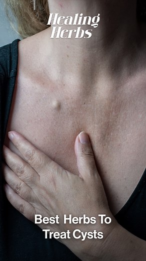 Cysts develop due to blocked ducts, which can cause a build-up of fluid. Some cysts are cancerous and early treatment is recommended. You can help drain cysts by applying a warm compress and try not to pop it, as it could lead to an infection. Subscribe to our Youtube channel for more health facts 💚 https://www.youtube.com/channel/UCWj-GlrMZ-BZr9RS9WNIOIw?sub_confirmation=1 #womenshealth #homeremedies | Dherbs