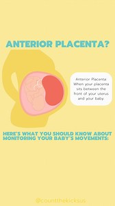 🟥Anterior Placenta: When your placenta sits between the front of your uterus and your baby. 🟥It’s quite common. 🟥Research indicates that having an anterior placenta may make those first movements harder to notice. 🟥As your baby continues to grow you will feel your baby’s movements more and start to notice a pattern in those movements as you start your third trimester. 🟥Counting your baby’s movements is still possible with an anterior placenta! 🟥We recommend sitting or lying down in a comfo