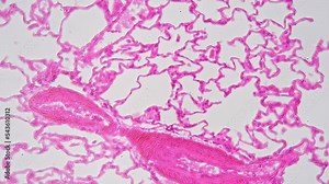 Section of lung tissues under microscope magnified in 200 times against bright field background. Learning organs of respiratory system and discovering its cells structure. Anatomy research concept Stock Video