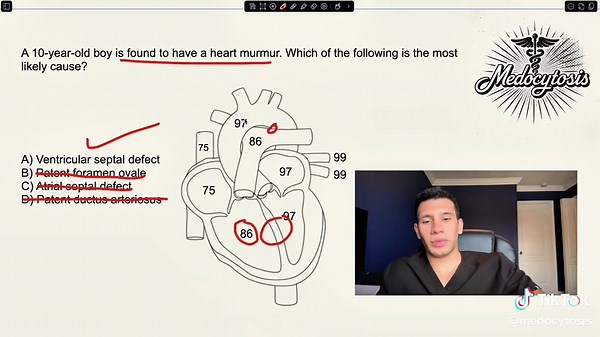 Understanding Congenital Heart Defects for Medical Exams