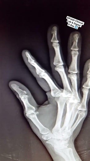 Portable Digital X-Ray 🩻 #alfalah #anatomy #digitalxray #doctor #radiology