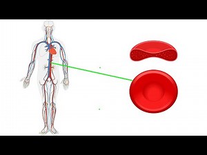 Watch how to sign 'red blood cell' in American Sign Language.