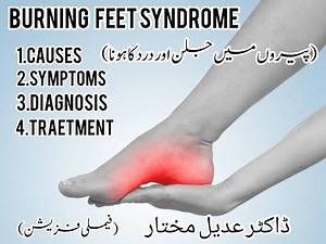 Burning Feet Syndrome Causes, Symptoms, Treatment and Prevention