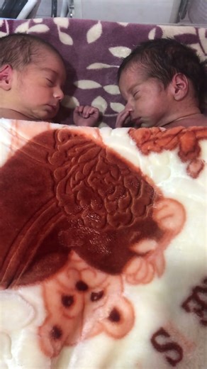 “Cute Twin Babies Part 2 💕🍼 | Double Cuteness #TwinBabies #NICUCare”